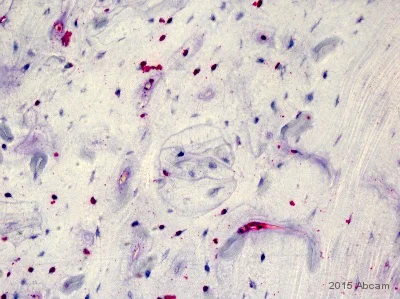 Immunohistochemistry (Formalin/PFA-fixed paraffin-embedded sections) - Anti-DNA/RNA Damage antibody [15A3] (AB62623)