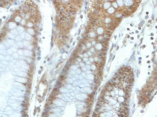 Immunohistochemistry (Formalin/PFA-fixed paraffin-embedded sections) - Anti-DNA2 antibody (AB197283)
