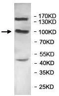 Western blot - Anti-DNA2 antibody (AB197283)