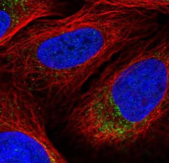 Immunocytochemistry/ Immunofluorescence - Anti-DNA2 antibody (AB220883)