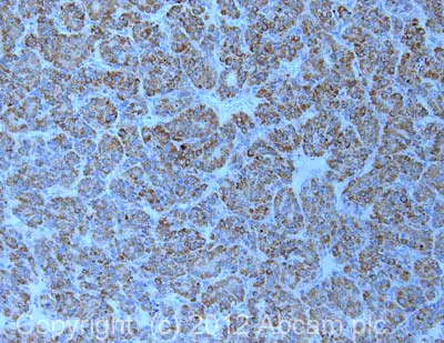 Immunohistochemistry (Formalin/PFA-fixed paraffin-embedded sections) - Anti-DNA2 antibody (AB96488)