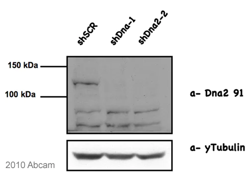 Western blot - Anti-DNA2 antibody (AB96488)