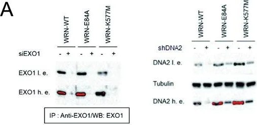 Western blot - Anti-DNA2 antibody (AB96488)