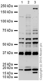 Western blot - Anti-DNA2 antibody (AB96488)