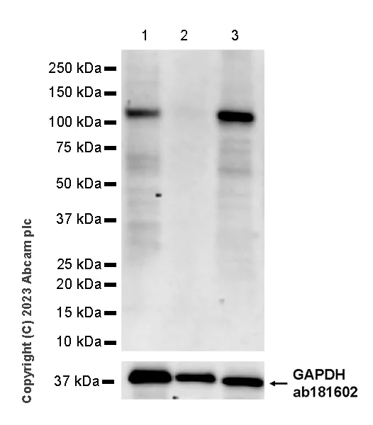 Western blot - Anti-DNA2 antibody [EPR28420-90] (AB315470)