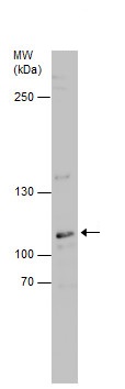 Western blot - Anti-DNA2 antibody - N-terminal (AB229457), expandable thumbnail