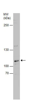 Western blot - Anti-DNA2 antibody - N-terminal (AB229457)