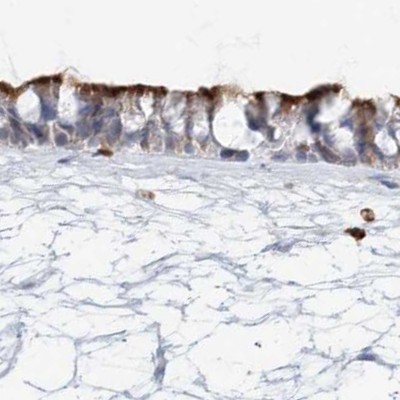 Immunohistochemistry (Formalin/PFA-fixed paraffin-embedded sections) - Anti-DNAH5 antibody (AB122391)