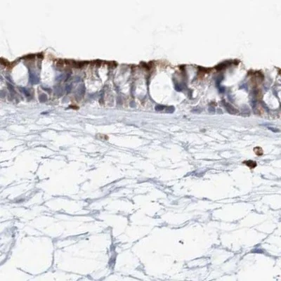 Immunohistochemistry (Formalin/PFA-fixed paraffin-embedded sections) - Anti-DNAH5 antibody (AB122391)