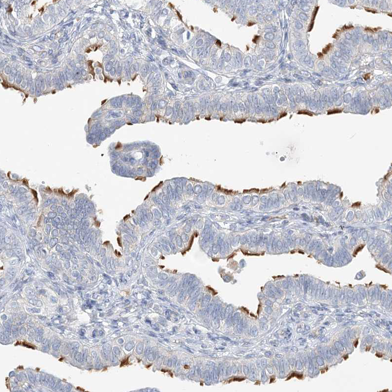 Immunohistochemistry (Formalin/PFA-fixed paraffin-embedded sections) - Anti-DNAH5 antibody (AB122391)
