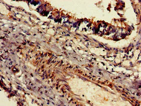 Immunohistochemistry (Formalin/PFA-fixed paraffin-embedded sections) - Anti-DNAH5 antibody (AB234826)