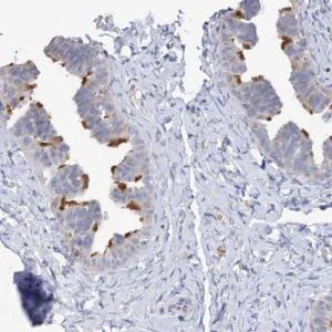 Immunohistochemistry (Formalin/PFA-fixed paraffin-embedded sections) - Anti-DNAH6 antibody (AB122333)