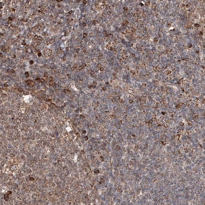 Immunohistochemistry (Formalin/PFA-fixed paraffin-embedded sections) - Anti-DNAH8 antibody (AB121989), expandable thumbnail