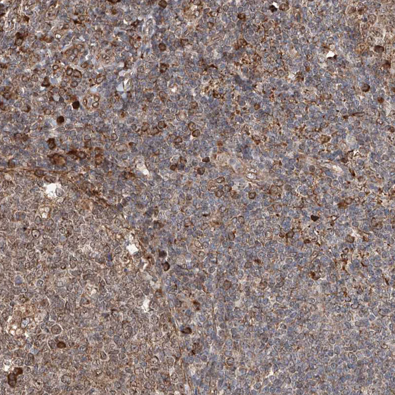 Immunohistochemistry (Formalin/PFA-fixed paraffin-embedded sections) - Anti-DNAH8 antibody (AB121989)