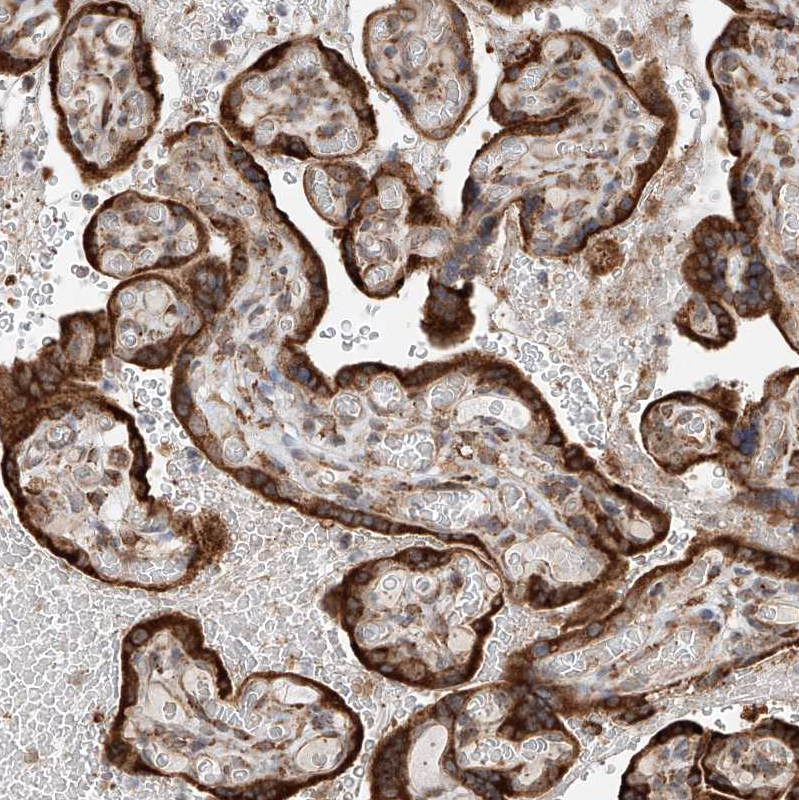 Immunohistochemistry (Formalin/PFA-fixed paraffin-embedded sections) - Anti-DNAH8 antibody (AB121989), expandable thumbnail