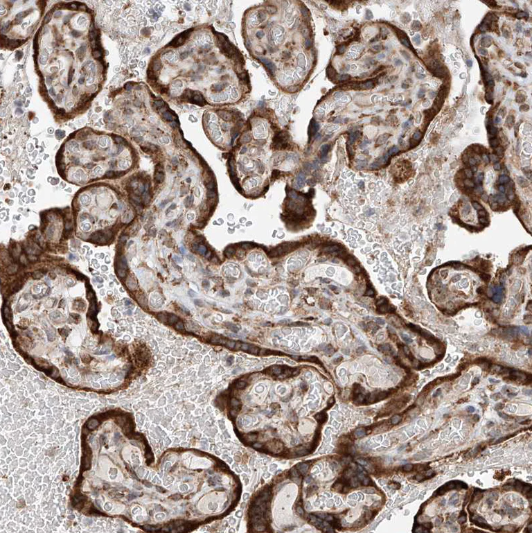 Immunohistochemistry (Formalin/PFA-fixed paraffin-embedded sections) - Anti-DNAH8 antibody (AB121989)