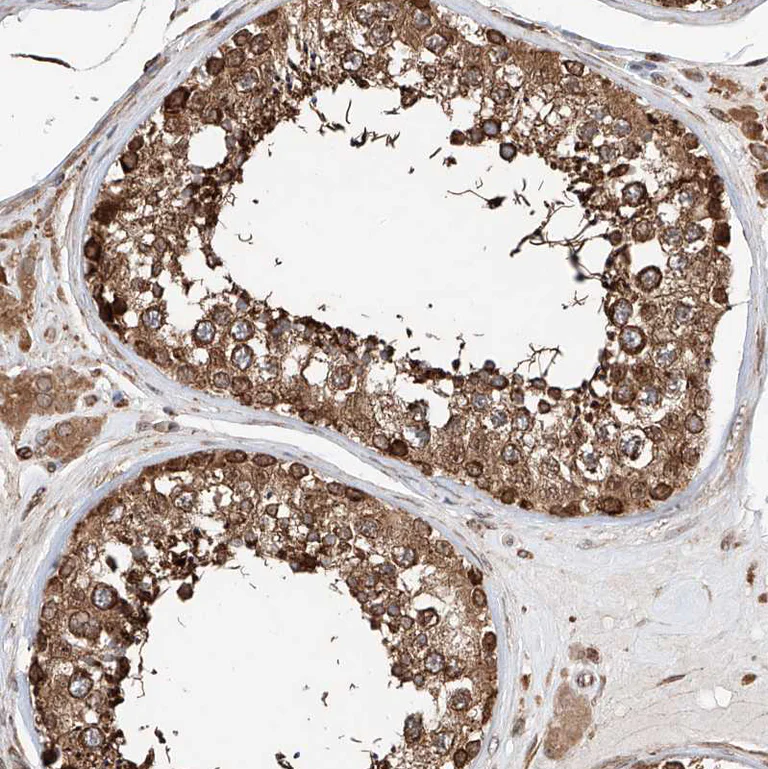 Immunohistochemistry (Formalin/PFA-fixed paraffin-embedded sections) - Anti-DNAH8 antibody (AB121989)