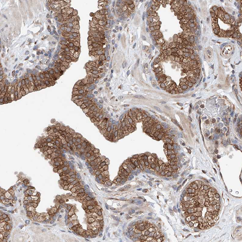 Immunohistochemistry (Formalin/PFA-fixed paraffin-embedded sections) - Anti-DNAH8 antibody (AB121989), expandable thumbnail
