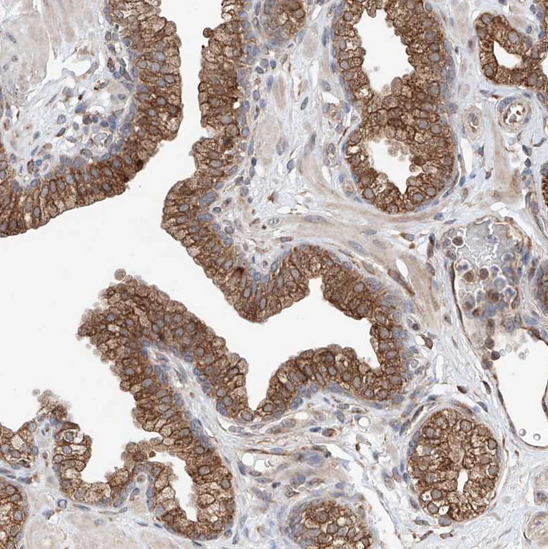 Immunohistochemistry (Formalin/PFA-fixed paraffin-embedded sections) - Anti-DNAH8 antibody (AB121989)