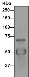 Immunoprecipitation - Anti-DNAI2 antibody [EPR11224] (AB170920)