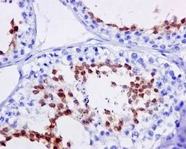 Immunohistochemistry (Formalin/PFA-fixed paraffin-embedded sections) - Anti-DNAI2 antibody [EPR11224] - BSA and Azide free (AB249591)