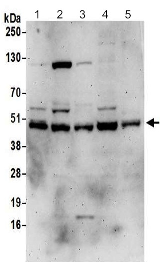 Western blot - Anti-DNAJA1 antibody (AB192904)