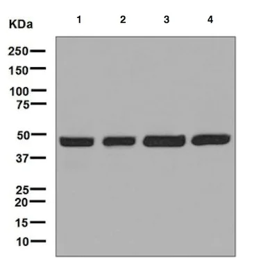 Western blot - Anti-DNAJA1 antibody [EPR7248] (AB126774)