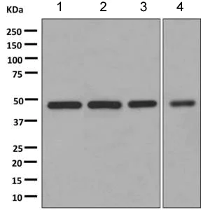 Western blot - Anti-DNAJA2 antibody [EPR11301(B)] (AB168365)