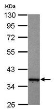 Western blot - Anti-DNAJB5 antibody (AB101514), expandable thumbnail