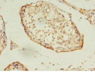 Immunohistochemistry (Formalin/PFA-fixed paraffin-embedded sections) - Anti-DNAJB5 antibody (AB234992), expandable thumbnail