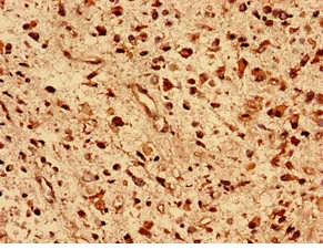 Immunohistochemistry (Formalin/PFA-fixed paraffin-embedded sections) - Anti-DNAJB5 antibody (AB234992)