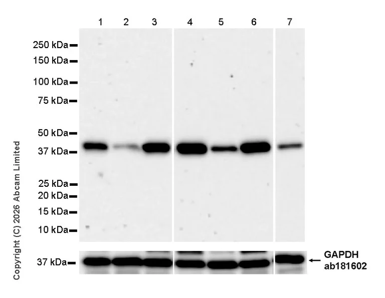 Western blot - Anti-DNAJB5 antibody [EPR31030-6] (AB326999)