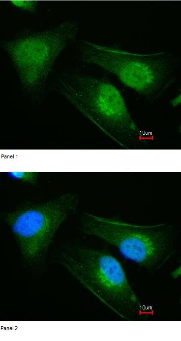 Immunocytochemistry/ Immunofluorescence - Anti-DNAJB6 antibody (AB96539)