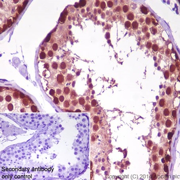 Immunohistochemistry (Formalin/PFA-fixed paraffin-embedded sections) - Anti-DNAJB6 antibody [EPR17122] - BSA and Azide free (AB240346), expandable thumbnail