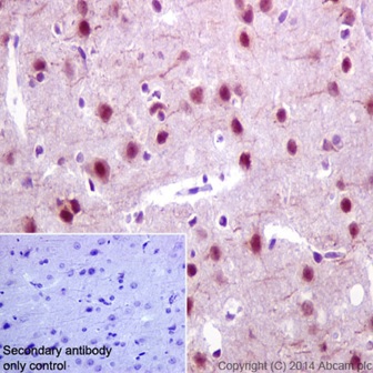 Immunohistochemistry (Formalin/PFA-fixed paraffin-embedded sections) - Anti-DNAJB6 antibody [EPR17122] - BSA and Azide free (AB240346), expandable thumbnail