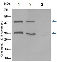 Immunoprecipitation - Anti-DNAJB6 antibody [EPR17122] - BSA and Azide free (AB240346), expandable thumbnail