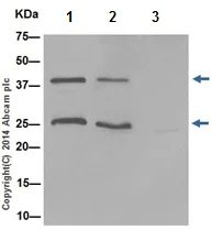 Immunoprecipitation - Anti-DNAJB6 antibody [EPR17122] - BSA and Azide free (AB240346)