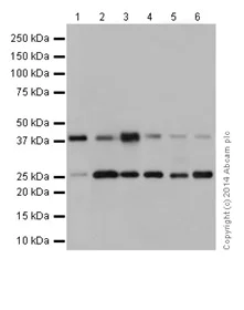Western blot - Anti-DNAJB6 antibody [EPR17122] - N-terminal (AB198995)