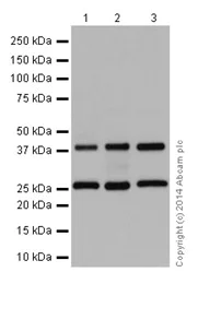 Western blot - Anti-DNAJB6 antibody [EPR17122] - N-terminal (AB198995)