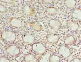 Immunohistochemistry (Formalin/PFA-fixed paraffin-embedded sections) - Anti-DNAJB8 antibody (AB235546)