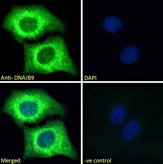 Immunocytochemistry - Anti-DNAJB9 antibody (AB118282), expandable thumbnail