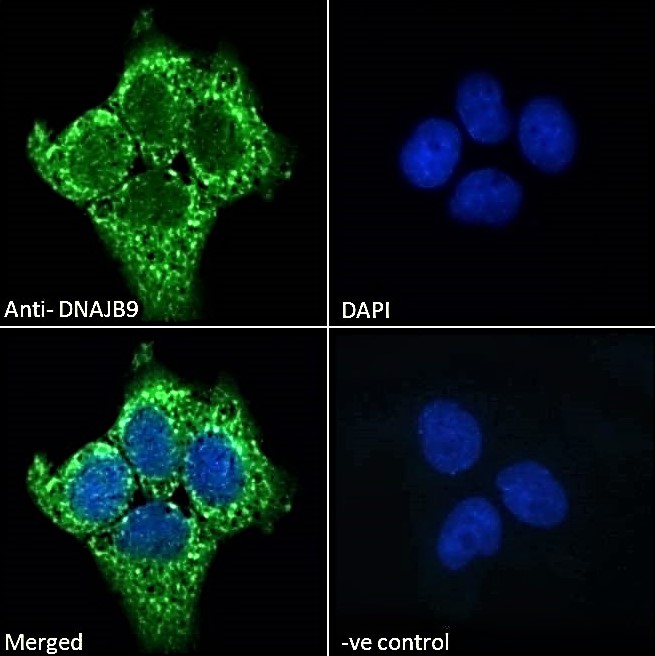 Immunocytochemistry - Anti-DNAJB9 antibody (AB118282), expandable thumbnail