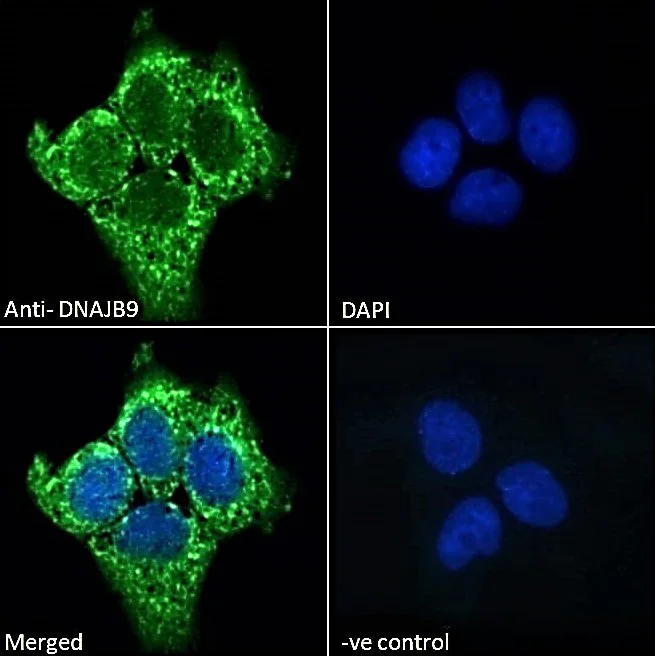 Immunocytochemistry - Anti-DNAJB9 antibody (AB118282)