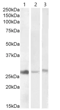 Western blot - Anti-DNAJB9 antibody (AB118282)