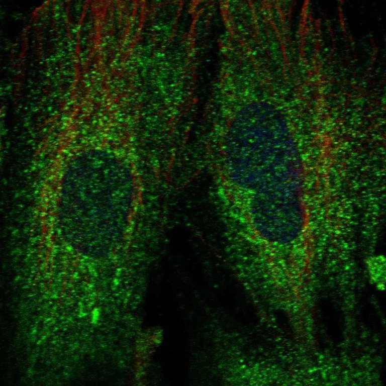 Immunocytochemistry/ Immunofluorescence - Anti-DNAJB9 antibody (AB251877)