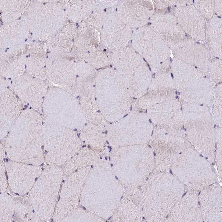 Immunohistochemistry (Formalin/PFA-fixed paraffin-embedded sections) - Anti-DNAJB9 antibody (AB251877)