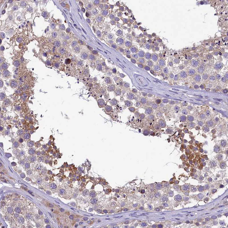 Immunohistochemistry (Formalin/PFA-fixed paraffin-embedded sections) - Anti-DNAJB9 antibody (AB251877)