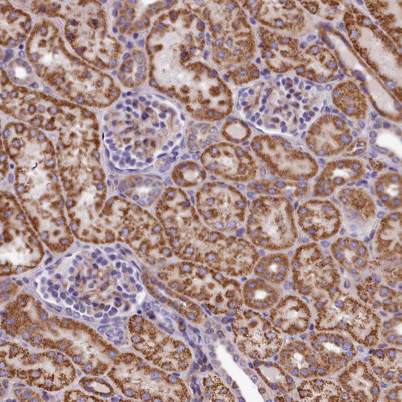 Immunohistochemistry (Formalin/PFA-fixed paraffin-embedded sections) - Anti-DNAJB9 antibody (AB251877)
