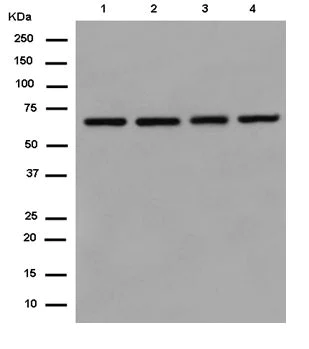 Western blot - Anti-DNAJC11 antibody [EPR15065(B)] - BSA and Azide free (AB250670)