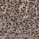 Immunohistochemistry (Formalin/PFA-fixed paraffin-embedded sections) - Anti-DNAJC14 antibody (AB121535)